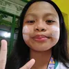 rose.kulit