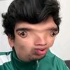 roelitopm5