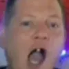 DKM's trauriger Zahn