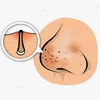 ClearSkinFix