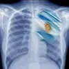 argentina_401