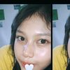 kyrchels