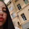 nonoreprv2