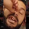 Kelooo