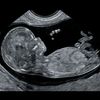 babyusg