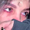 hwlaa3
