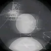 x98793