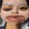 Đu đu sún răng