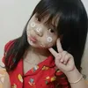 bi.cng.tuyn4