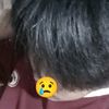 pighfdd