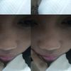 fitttt10