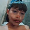 kalah__muka