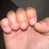 quitnailsbitingjourney