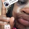 zy_bug_