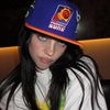 albina’