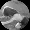 erdq66