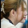 zoylin_chk