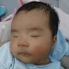 taphoabetit