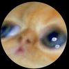 joset_nose1
