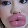 biglips2025