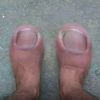 toenails69690