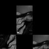 steehs_mar