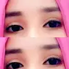reemzbbh2