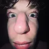 binckdl2