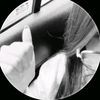 marbe_164