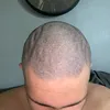 baasop59