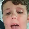 izanllote