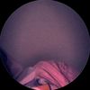 ii.am._nylaa