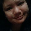 myo.pa.pa.soe53