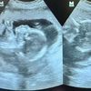 baby.mama4513