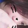 pe_ri_chupinnn