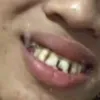 ngphnglm