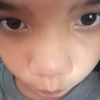 proy_31