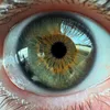 rareiris
