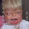 unclipped_toenail0