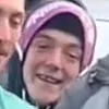 english.missing.teeth