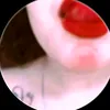e_li8g2