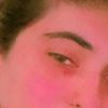 eyespain2