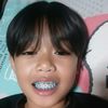 bass_25571