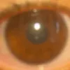 eayh_