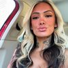 girlwithalipscar