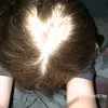 kkelive