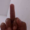 botak_lol2
