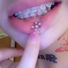 fkkll2