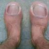 ticklematoes7