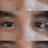 _hii_ini_tia_4
